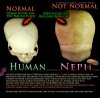 Nephilim-Skull-Suture-Human-Skull-Suture-Nephilim-Humanoid-Hybrid-Examination-Nephilim-Trey-Smit.jpg